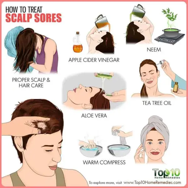 www.top10homeremedies.com