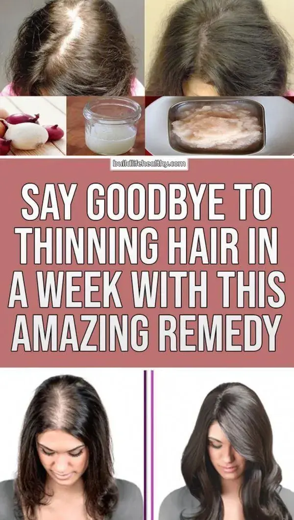 She Had Very Thin Hair, But She Used This Ingredient And Got Thick Hair Within A Week