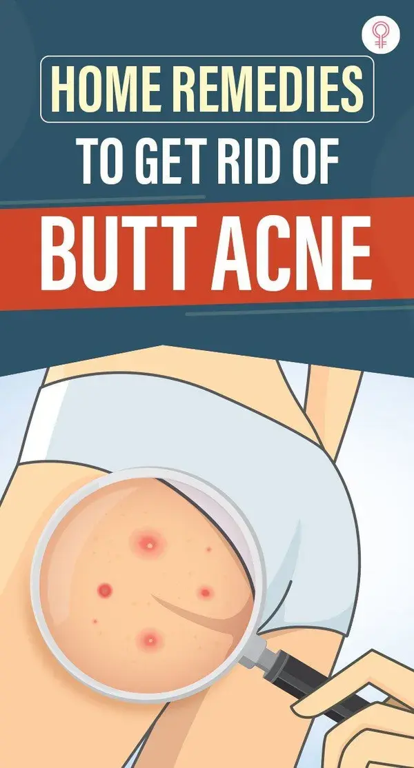 Home Remedies To Get Rid Of Butt Acne