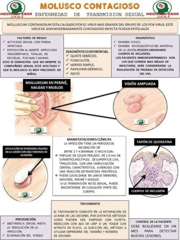 Cómo evitar el envejecimiento vaginal, de forma sencilla