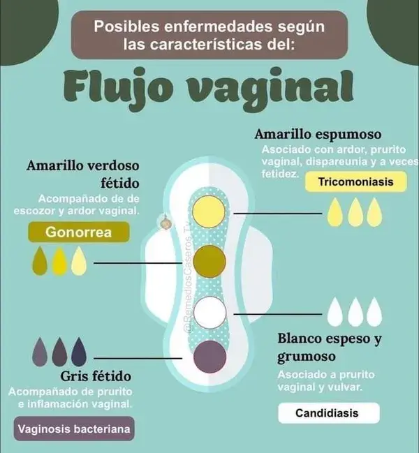 Acaso has analizado tu flujo vaginal?!