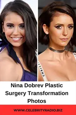 Nina Dobrev Plastic surgery Transformation photos