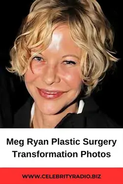Meg Ryan Plastic Surgery Transformation photos