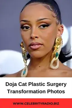 Doja Cat Plastic Surgery Transformation Photos