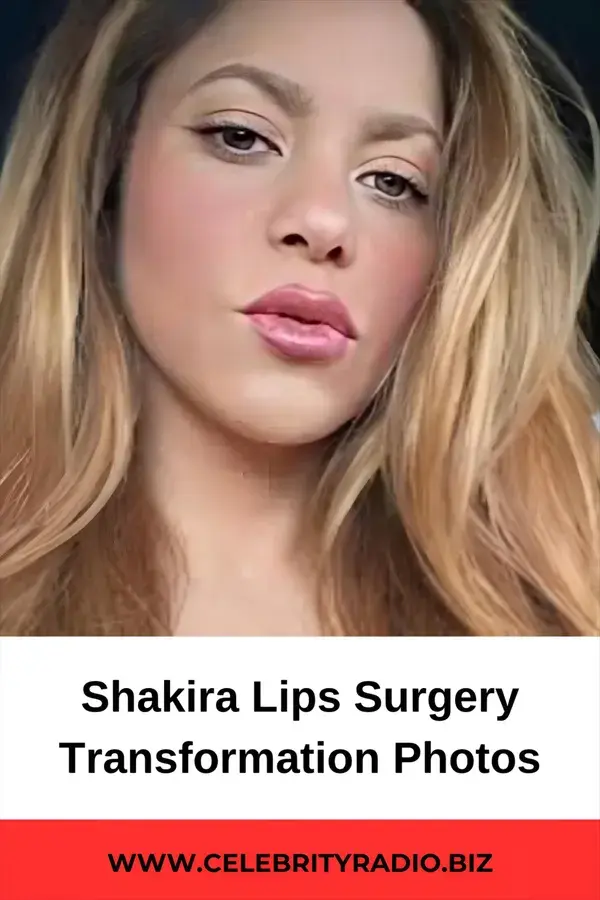 Shakira Lips Surgery Transformation Photos