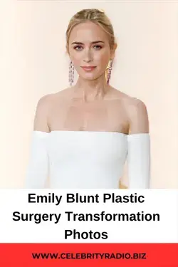 Emily Blunt Plastic Surgery Transfrmation Photos