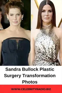 Sandra Bullock Plastic surgery Transformation photos