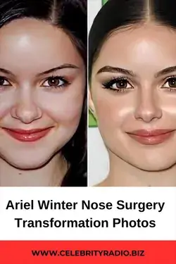 Ariel Winter Nose Surgery Transformation Photos