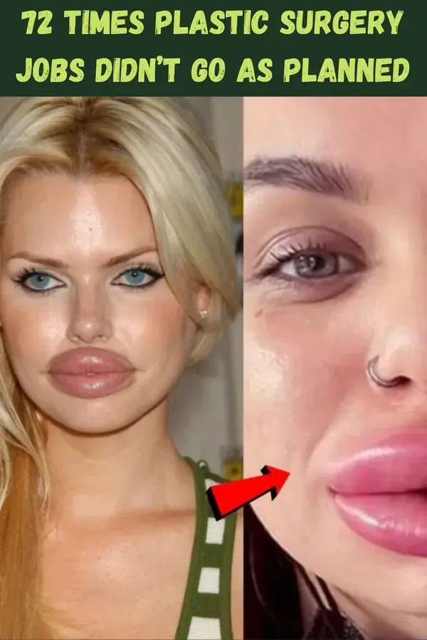 72 times plastic surgery jobs didn’t go as planned