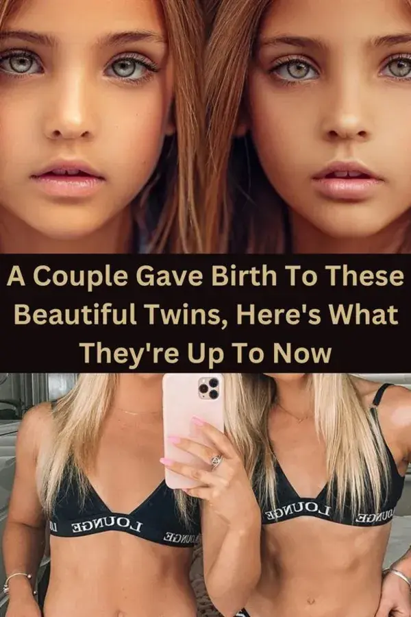 A Couple Gave Birth To These Beautiful Twins, Here's What They're Up To Now