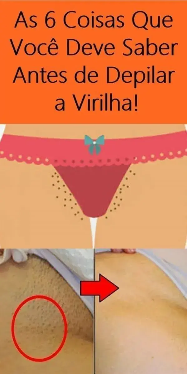 Como clarear a virilha de forma eficiente e sem causar danos à pele