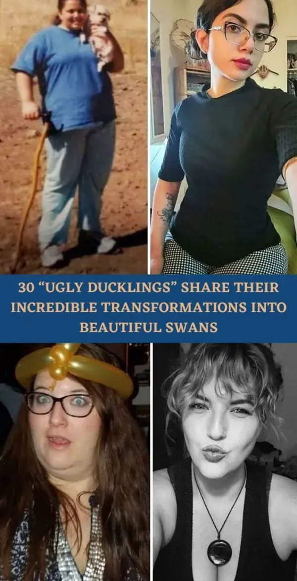 30 “Ugly Ducklings” Share Their Incredible Transformations Into Beautiful Swans