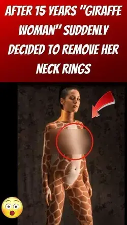 After 15 Years "Giraffe Woman" Suddenly Decided To Remove Her Neck Rings