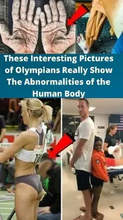 These Interesting Pictures of Olympians Really Show The Abnormalities of the Human Body