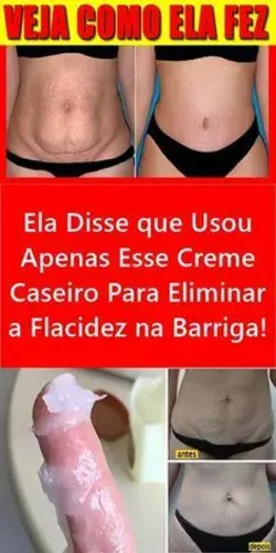 Creme Caseiro Para Eliminar Estrias e Flacidez na Pele!