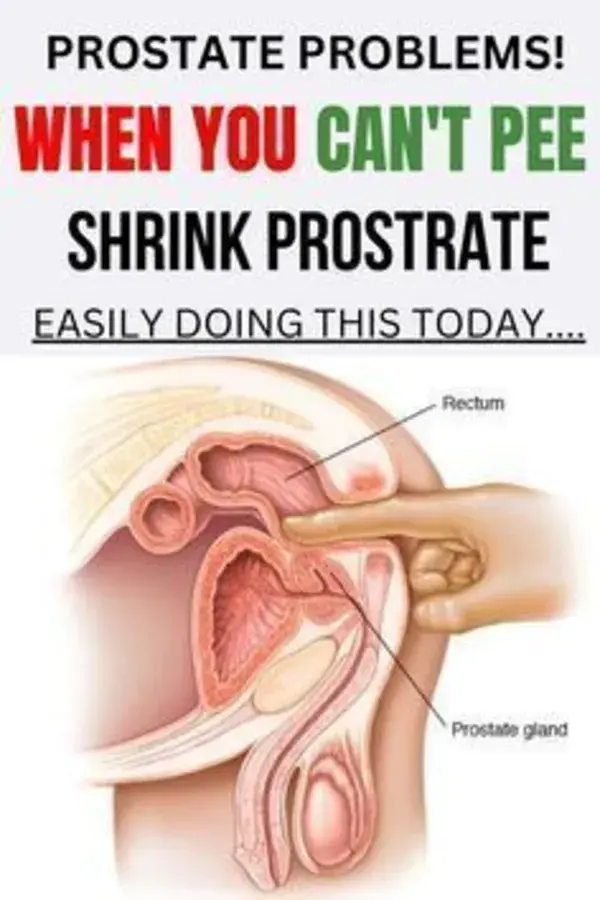 Discover the simple trick that helped me treat my enlarged prostate naturally! Try it today!