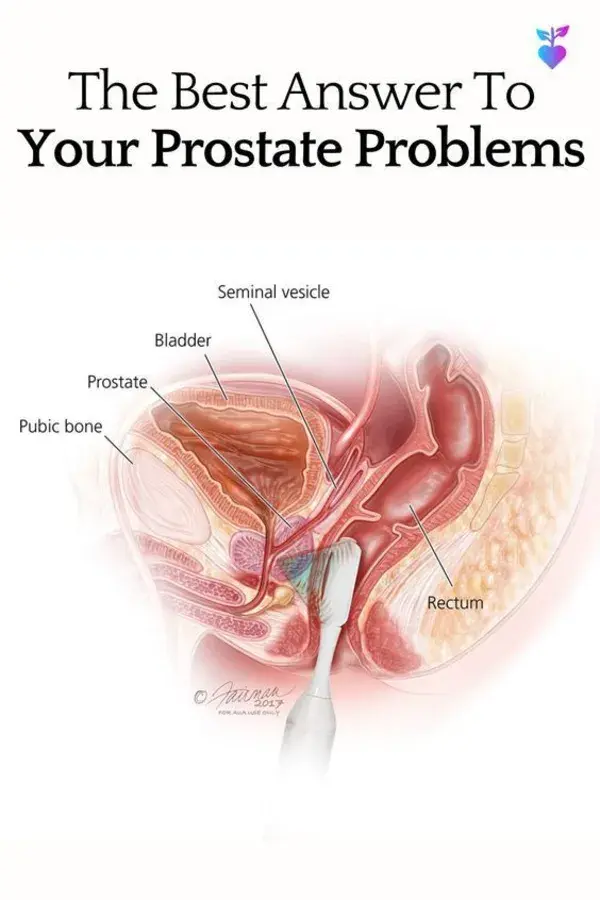 The Best Answer To Your Prostate Problems