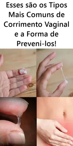 Esses são os Tipos Mais Comuns de Corrimento Vaginal e a Forma de Preveni-los!