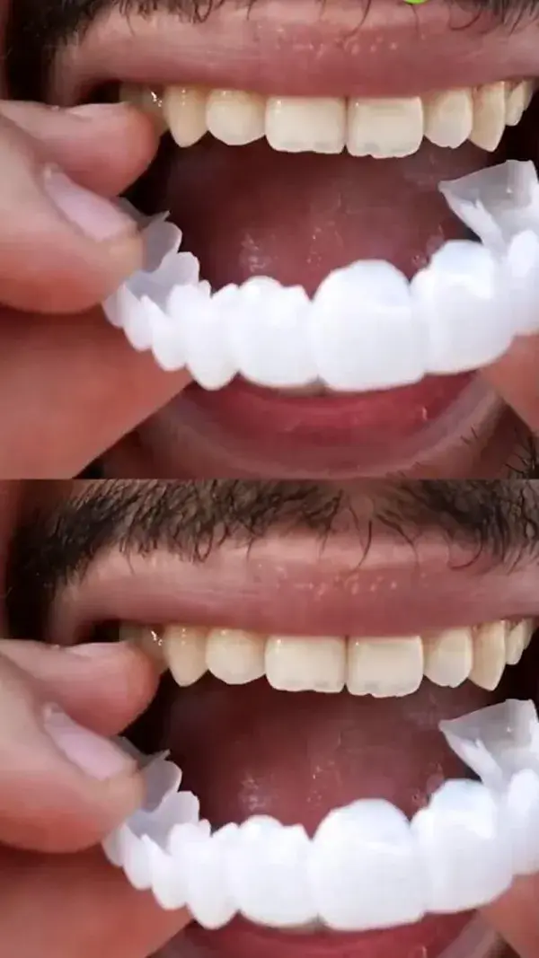 Amazing teeth product DM Now 🛒