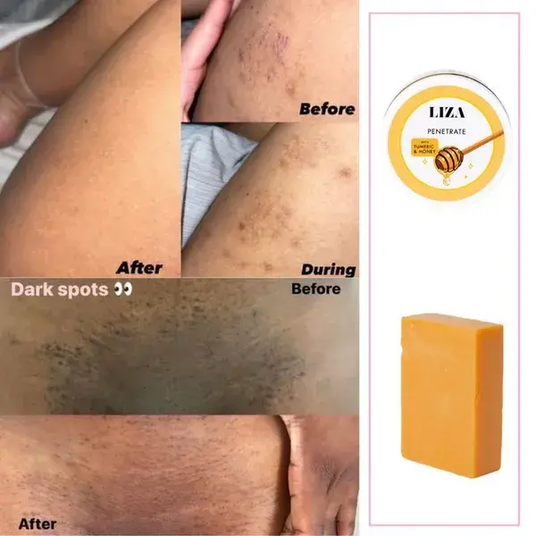 Dark spot corrector, turmeric products, dark spot remover