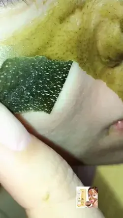 Black head removing satisfying video with Honey mask 💥