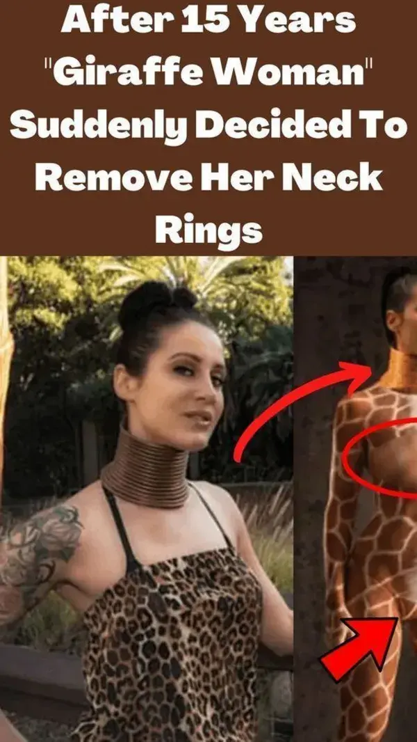 After 15 Years _Giraffe Woman_ Suddenly Decided To Remove Her Neck Rings