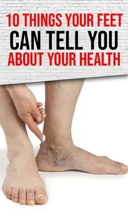 What Your Feet Say about Your Health: 10 Warning Things to Pay Attention to