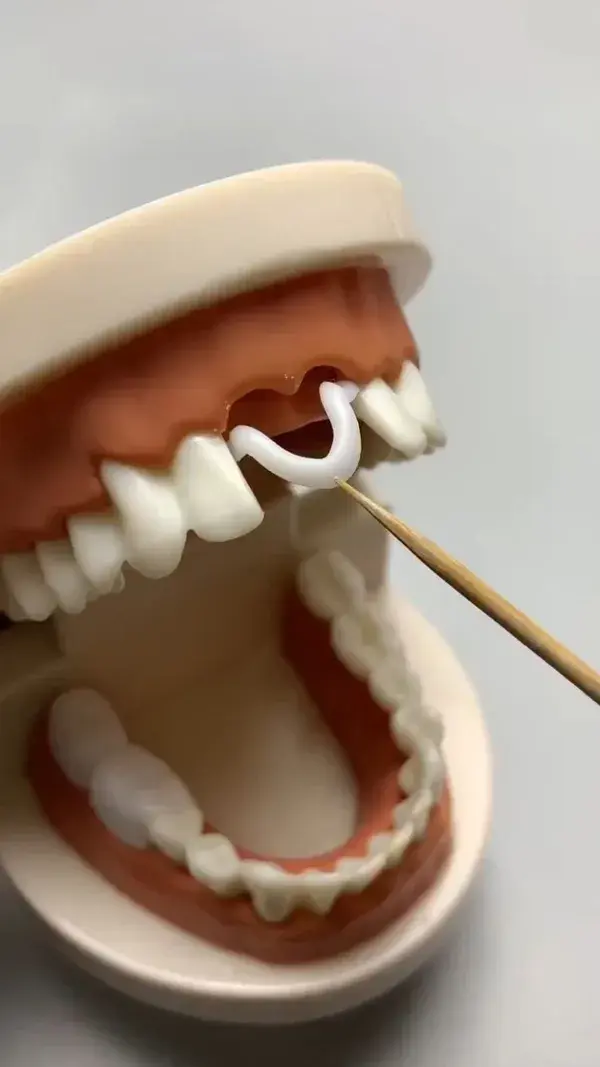 What's this 😳😬🦷