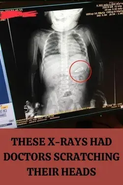 These X-Rays Had Doctors Scratching Their Heads