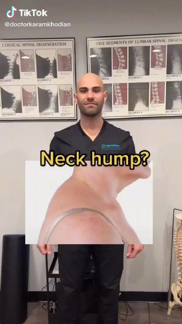 Neck hump?