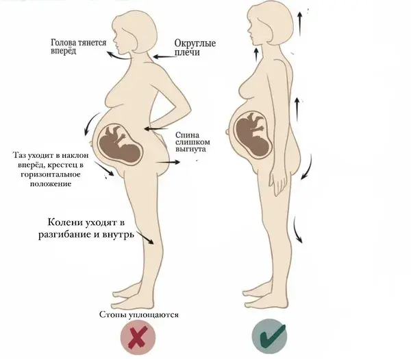 Осанка во время беременности.