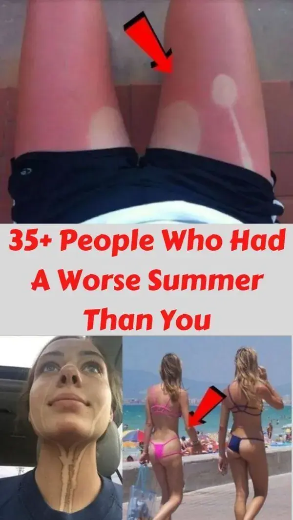 35+ People Who Had A Worse Summer Than You