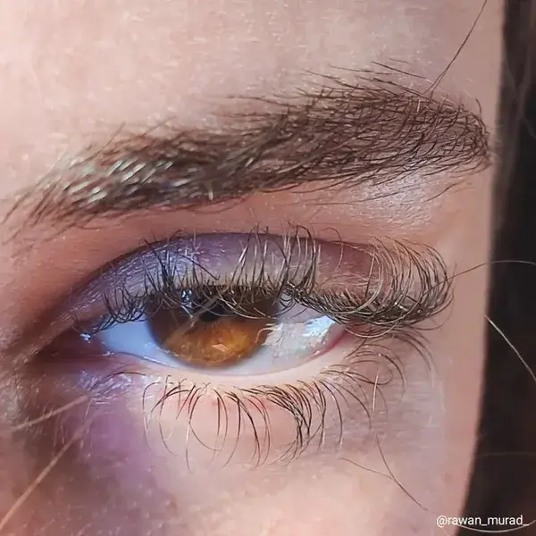 Eye