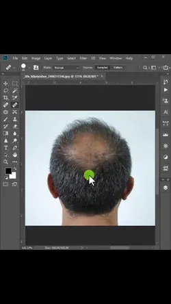 An easy technique for Hair transplant in photoshop #graphicstipsland