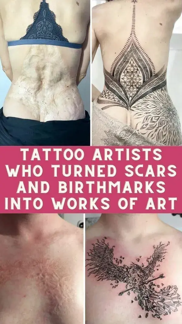 Tattoo Artists Who Turned Scars and Birthmarks Into Works of Art