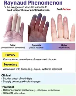 Raynaud Phenomenon