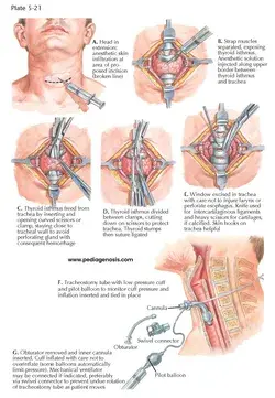 pediagenosis