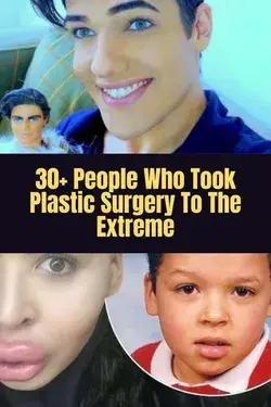 30+ People Who Took Plastic Surgery To The Extreme