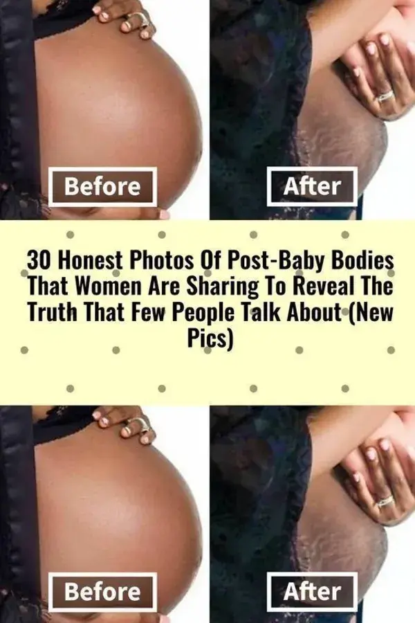 30 Honest Photos Of Post-Baby Bodies That Women Are Sharing To Reveal The Truth That Few People Tal