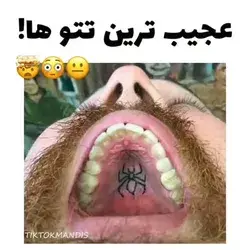 تو چشم اخه...😐