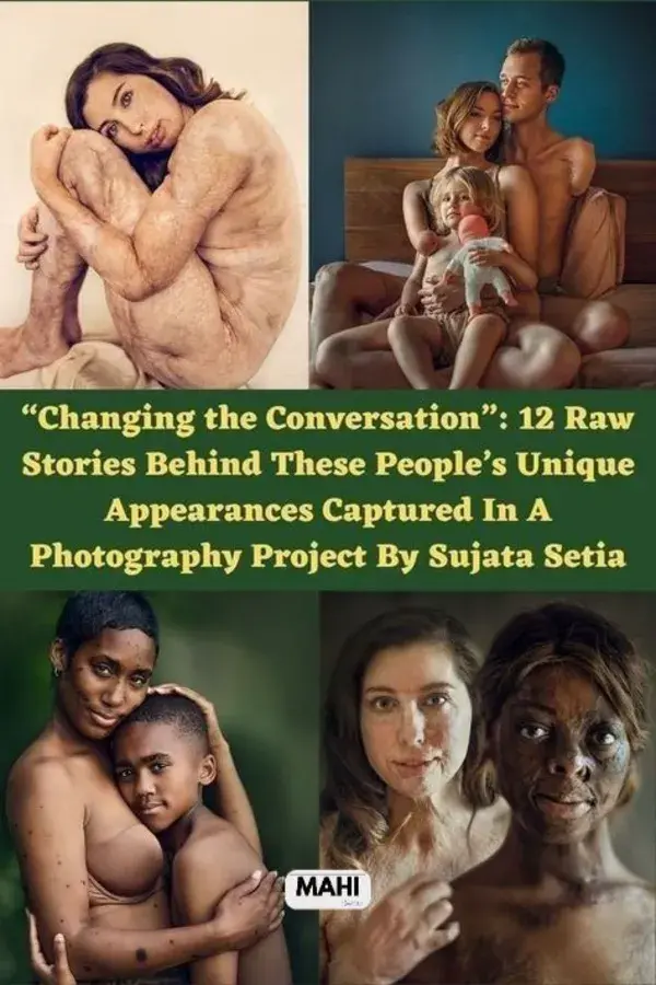 “Changing the Conversation”: 12 Raw Stories Behind These People’s Unique