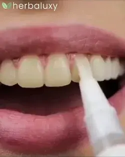 Teeth Whitenning