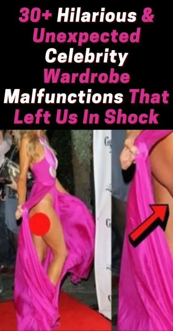 30+ Hilarious And Unexpected Celebrity Wardrobe Malfunctions That Left Us In Shock