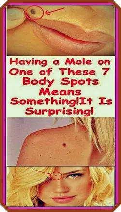 IF YOU HAVE A MOLE AT ONE OF THESE 7 PLACES ON YOUR BODY THIS IS WHAT IT MEANS!
