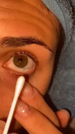 Soothing ASMR: Gentle Eye Care for Ultimate Relaxation 😌✨