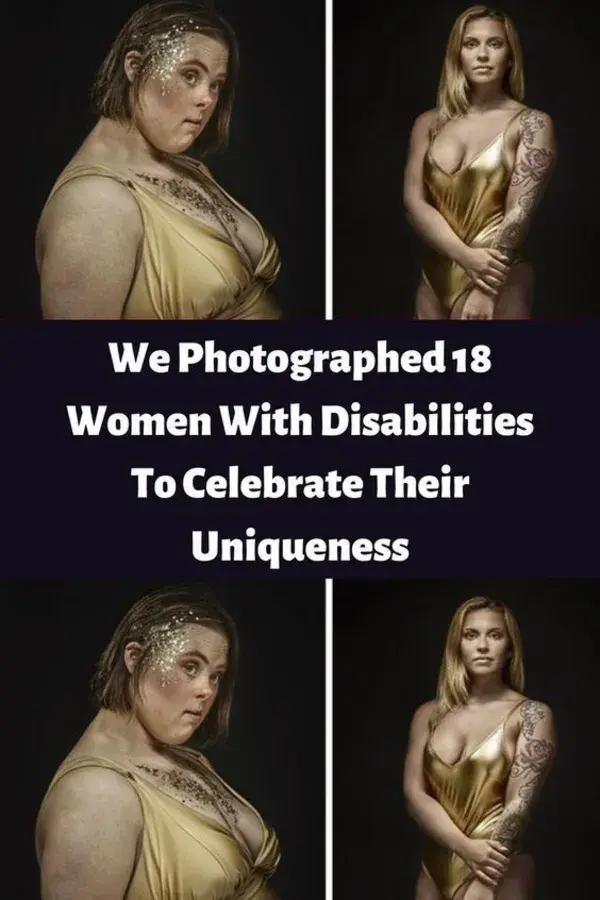 Disabilities To Celebrate Their Uniqueness