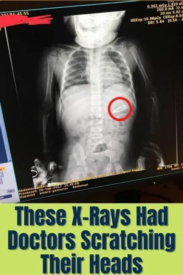 These X-Rays Had Doctors Scratching Their Heads