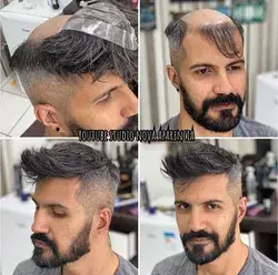 Thin skin toupee hair for men