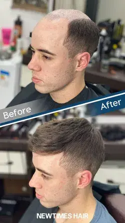 Men's hair replacement | Toupee hairstyles