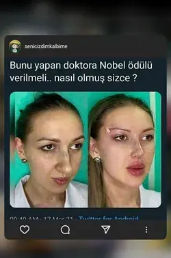 #Devrimgibievrim